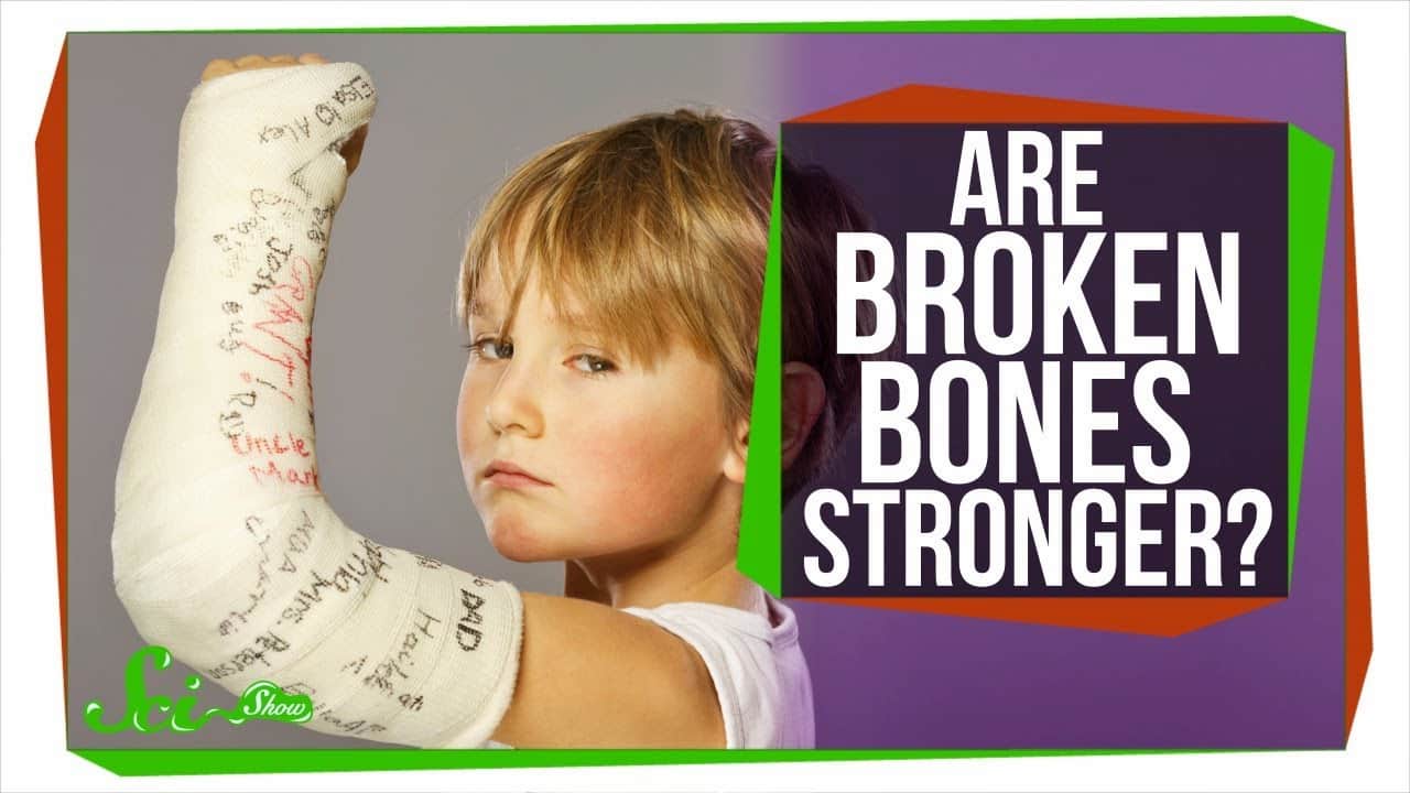 「骨折すると、その骨は強くなる」のは本当か？