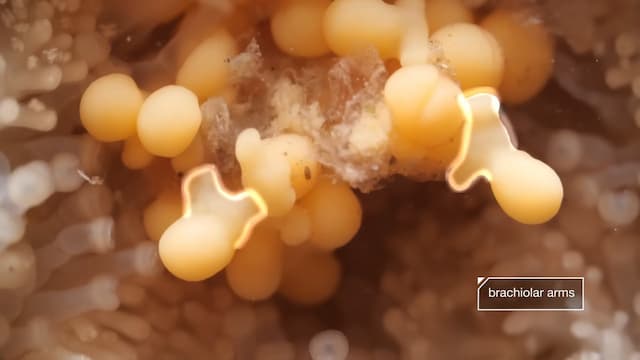 ヒトデの足